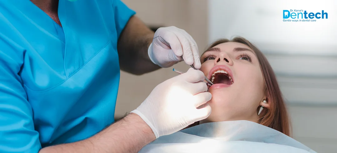 Dental Extractions Treatment in Powai at Dr. Karve's Dentech